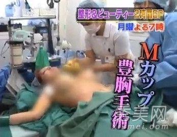 성형 수술 30회나 받은 日 여성, 가슴 성형 과정 공개