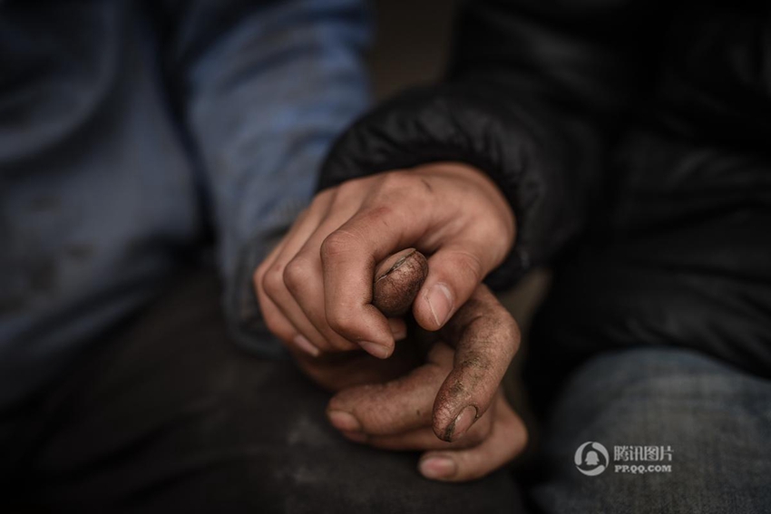 안후이 실명한 아버지 모시고 사는 13살 남자아이