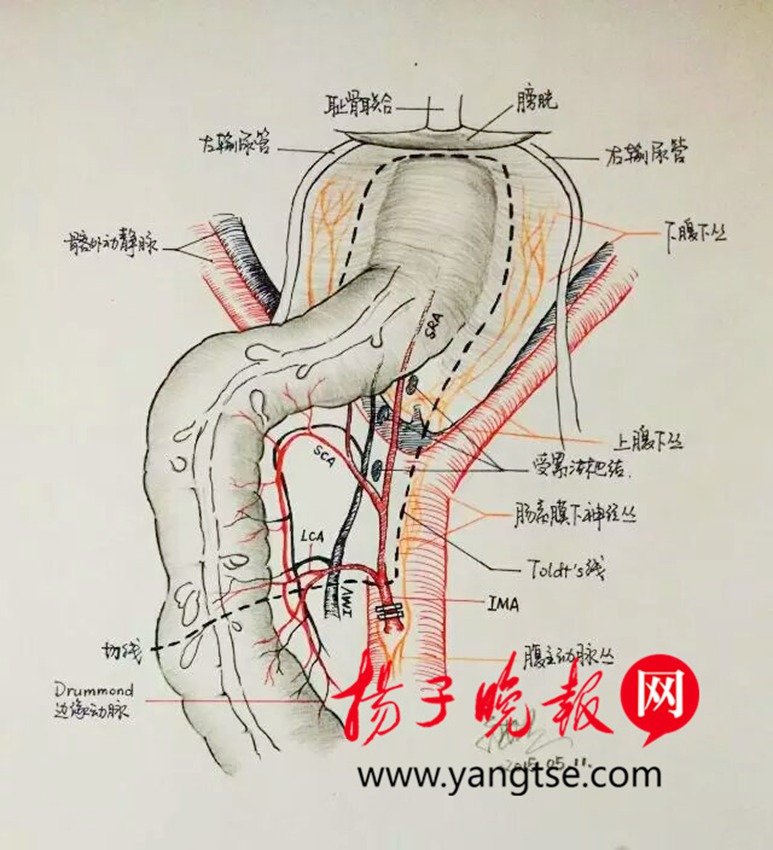 '친절한 의사' 수술부위 해부도 그려 자세히 설명