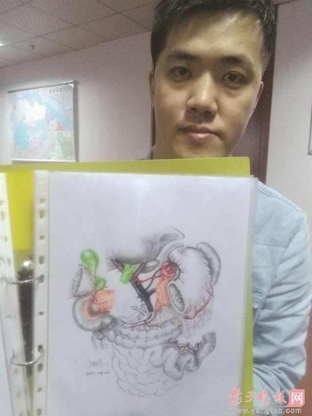 '친절한 의사' 수술부위 해부도 그려 자세히 설명