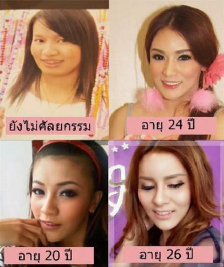 성형으로 성공한 한 태국 여성, 인생 역전!