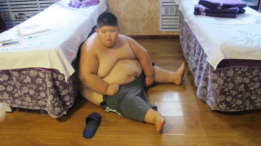 하얼빈 9세 남아 143kg, 비만으로 학교도 못 가