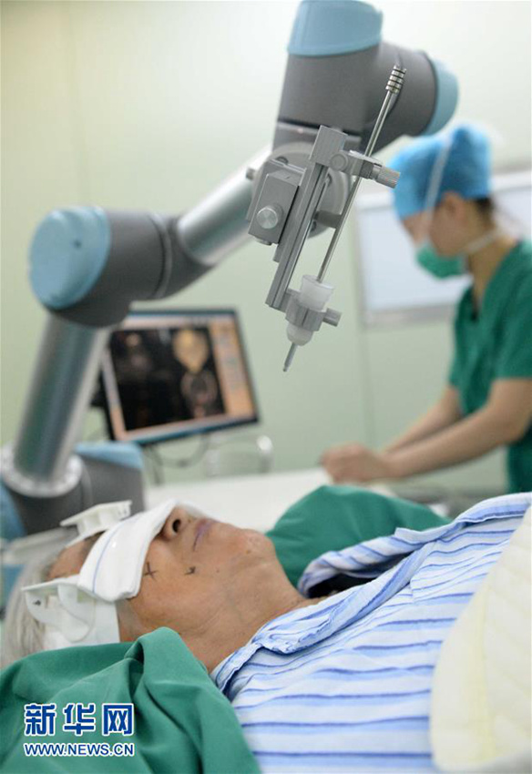 하얼빈 병원, ‘로봇 뇌정위 수술’ 성공
