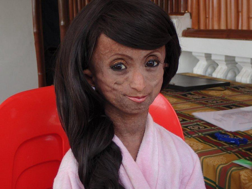 아시아 가장 ‘늙은’ 소녀 사망, 신체 나이는 150세