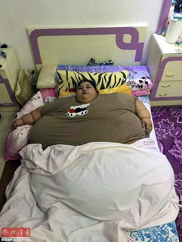 세계에서 가장 뚱뚱한 女, 25년간 누워 있어