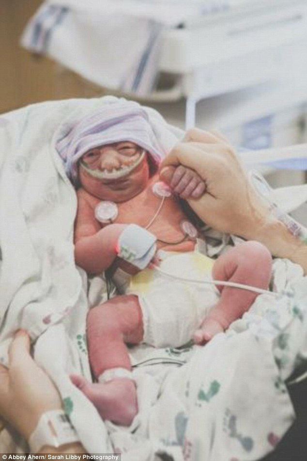 미국 무뇌아 딸 출산 결심한 어머니, 그녀의 사명감