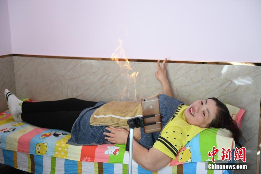 중국 안후이 1년간 115kg 감량한 뚱보 아줌마, 다이어트 방송으로 인기 스타!
