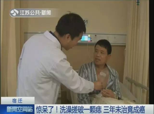 장쑤 한 男, 샤워하다 긁힌 상처 3년간 방치… 암으로 발전!