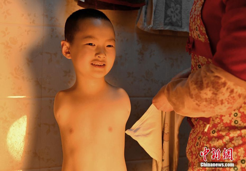 중국 쓰촨, 팔 없는 男兒의 행복한 학교생활