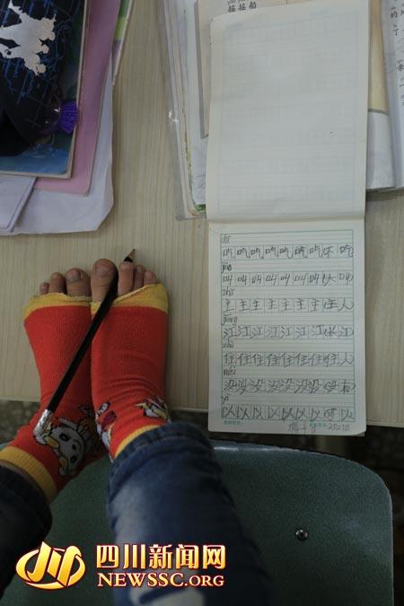 양팔 없는 中 쓰촨 8세 우등생… 양발로 ‘머리카락 줍기’ 연습