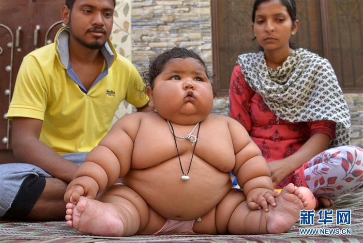 인도의 생후 8개월 ‘슈퍼 베이비’, 체중이 무려 17kg