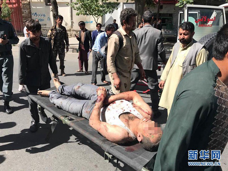 아프가니스탄 카불 대사관 근처서 폭발! 피해자 규모 아직…