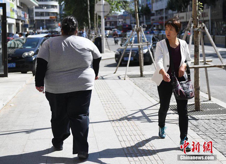 허베이 20대 여성 몸무게 200킬로에 달해, 다이어트 결심
