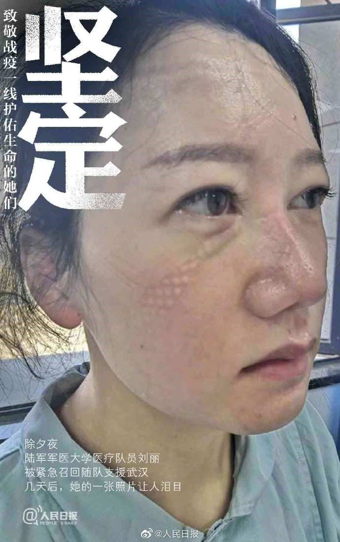끈기: 육군 군의대학교 의료대 소속 류리(劉麗) 대원은 즉각 우한 지원대로 편입했다. 며칠 후 찍은 그녀의 사진에 울컥할 수밖에 없다.
