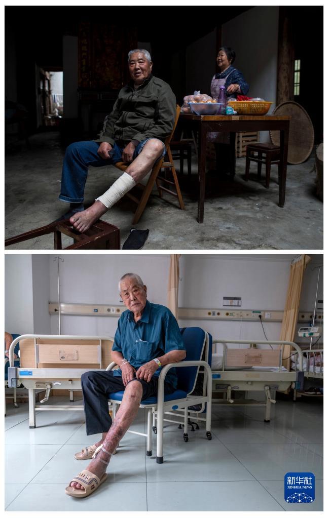 위 사진: 2015년 4월 19일, 펑환시(馮歡喜) 씨의 리수이시 집 모습; 아래 사진: 2021년 9월 7일, 리수이시 인민병원에 입원한 펑환시 씨