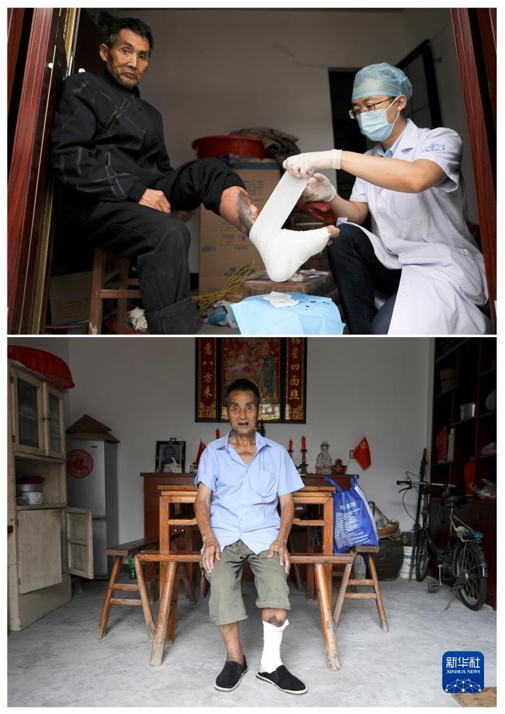 위 사진: 2020년 10월 15일, 의료 관계자가 우파구이(吳發貴) 씨 약 교환을 위해 집을 방문했다. 아래 사진: 2021년 9월 3일, 우파구이 씨가 자택에서 찍은 사진