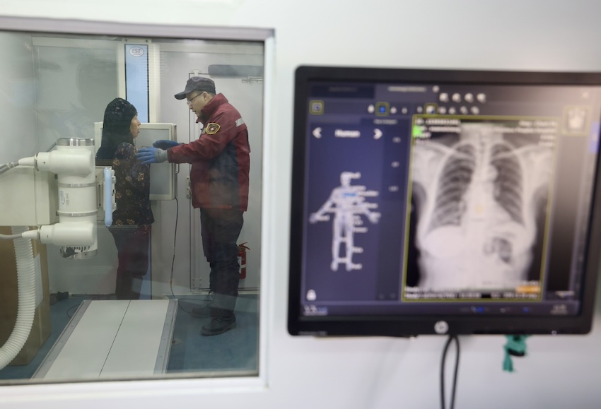 12월 21일 지스산현 다허자진의 임시 대피소, 의사가 엑스레이를 찍는다. 